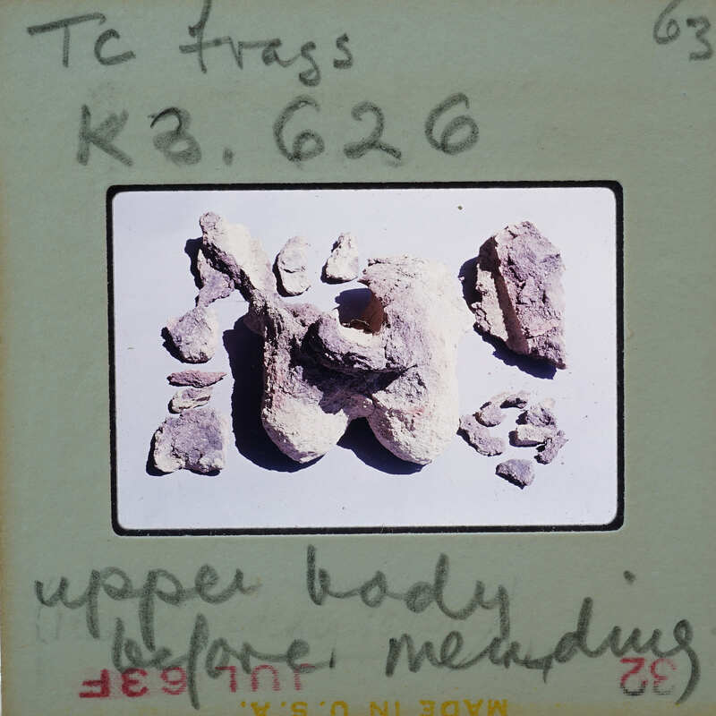 A collection of fragmented bones on a white surface, possibly from an upper body part.