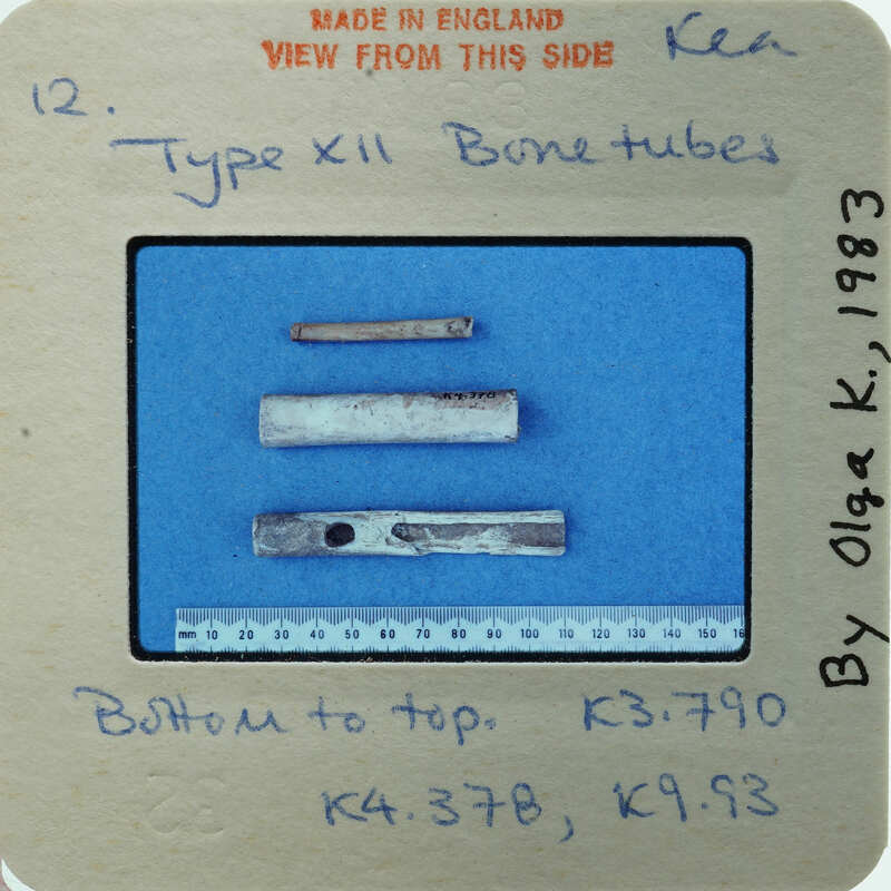 A collection of bone fragments displayed on a blue background with labels and measurements.