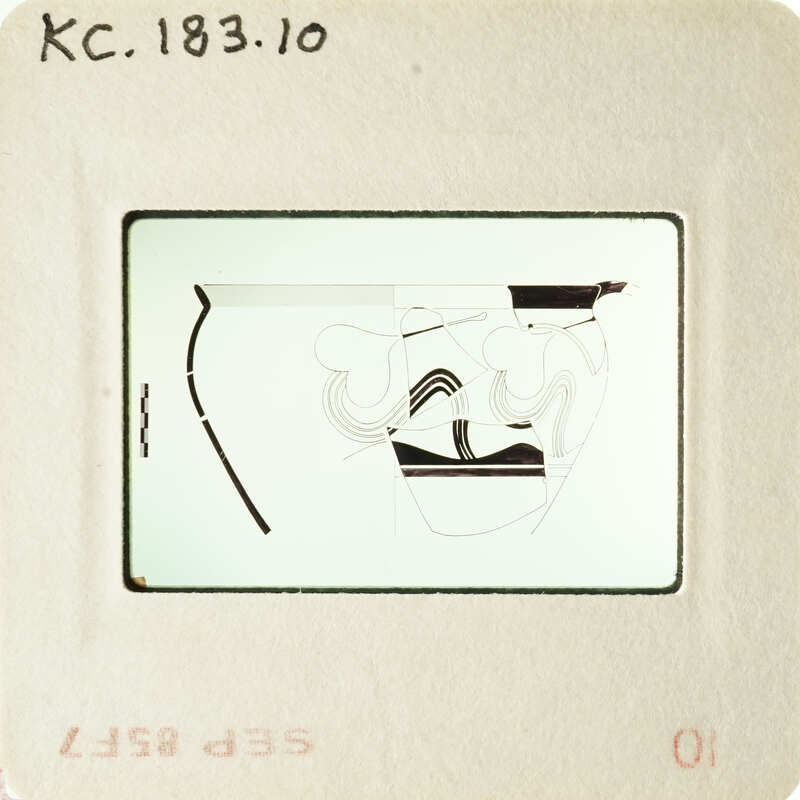 Illustration of human anatomy, specifically the digestive system, on an old slide with visible markings and handwriting.