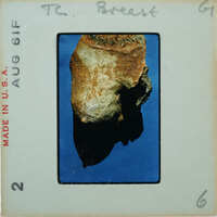 Detail of terracotta figurine breast fragment K1.460.