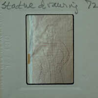 A vintage x-ray film with a handwritten label and an image of a human torso, possibly from the 1970s.