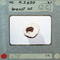 A close-up photograph of a small, round object with a hole in the center, possibly a fossil or an artifact, on a white background.